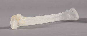 Small bone