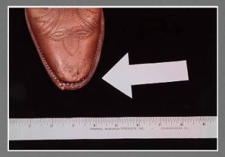 Exhibit D: Boot Toe Punctures