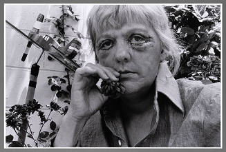 Self Image (from the series Face Lift)