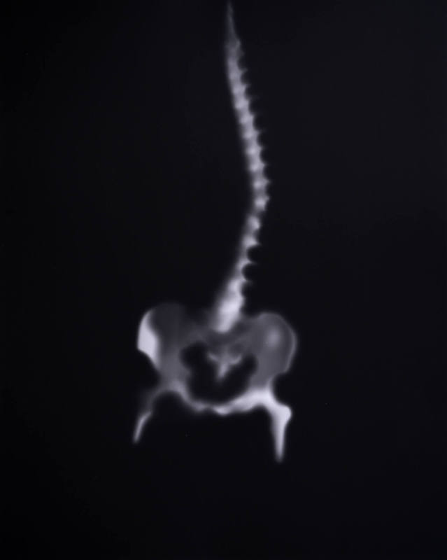Spine