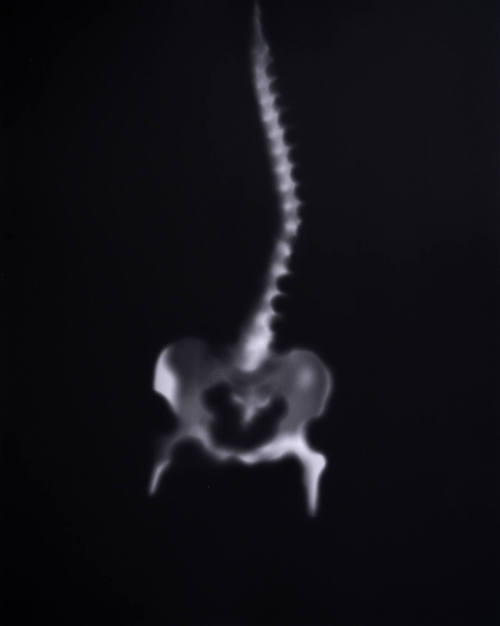 Spine